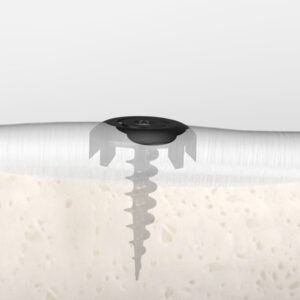 Tendon Anchor System™